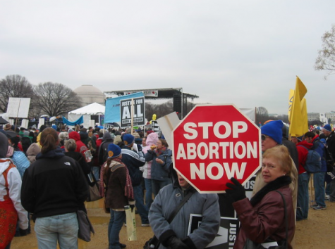Abortion, should it be legal?